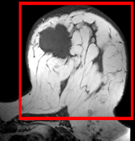 RegLib C06: Breast MRI pre/post