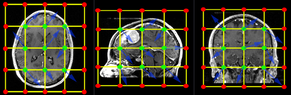Example of a 3x3x3 BSpline grid placed over the entire image. Note that the 3x3x3 grid refers to the green center points, which are allowed to move freely. The additional (red) boundary points do not move.