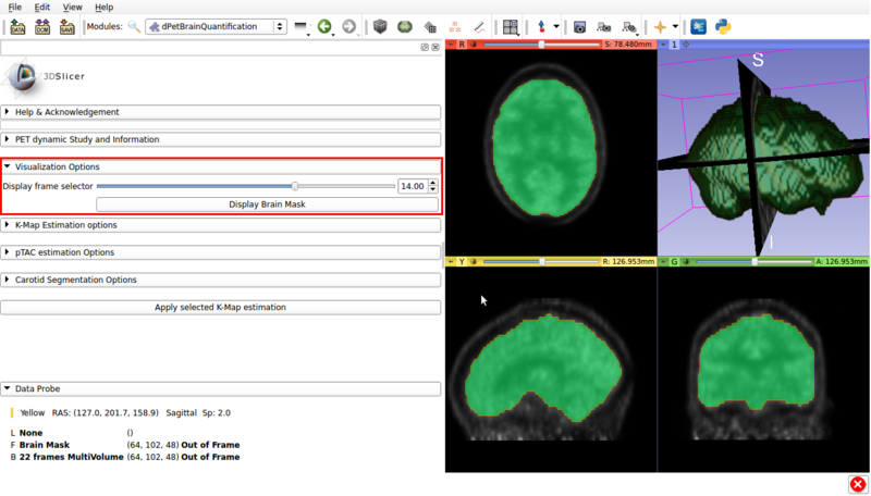 Figure 3. Visualization panel screencap. The segmented brain mask is displayed over the 14th frame of the imported dPET study.