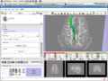 Slicer3 brainlabmodule navigate may3.png